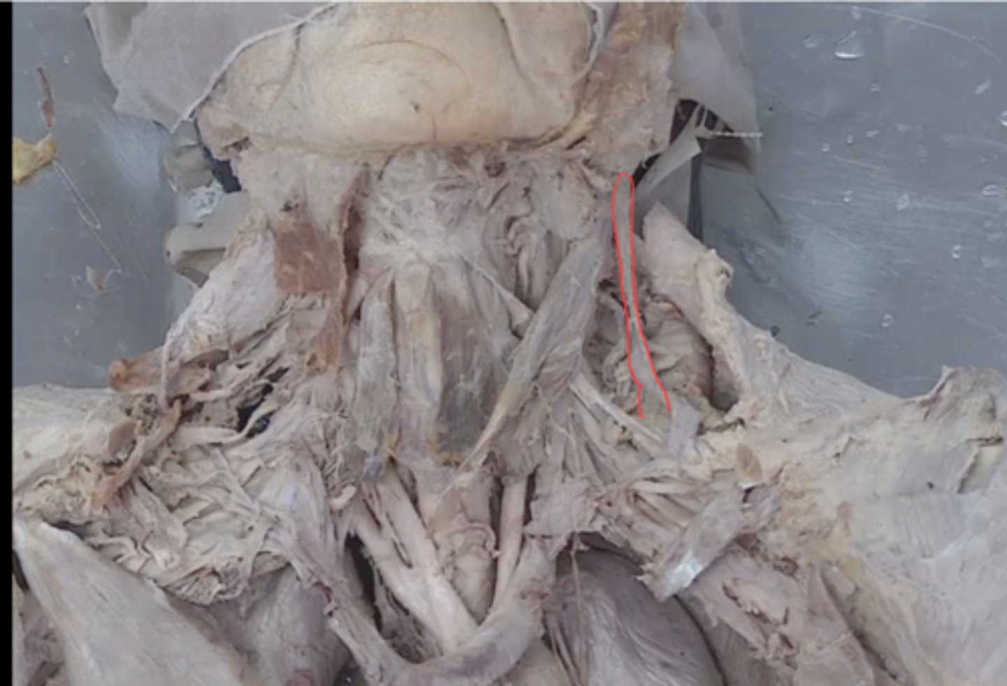 <p>identify this structure</p>