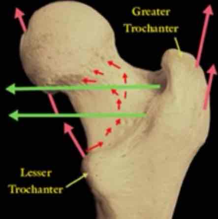 <p>cat #1 / v large, blunt irregular shape / greater &amp; lesser (not pal) trochanter of femur</p>