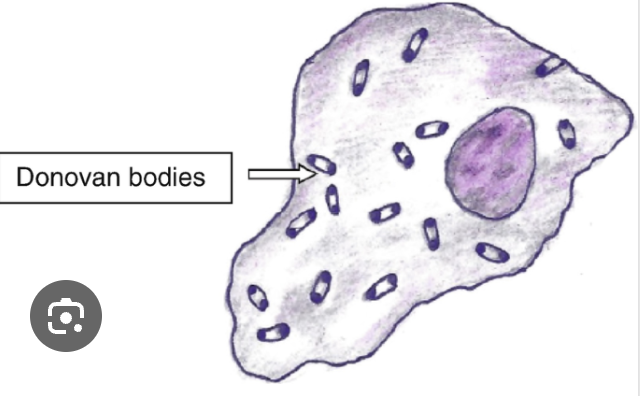 <p>Diagnosis for Granuloma Inguinale</p>