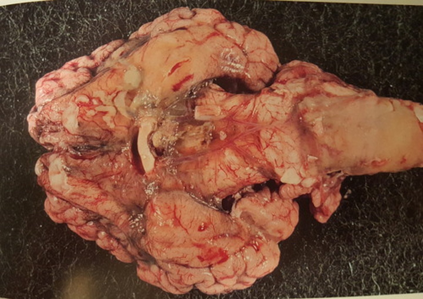 <p>Hjerne fra okse. Patoanatomisk diagnose?</p>