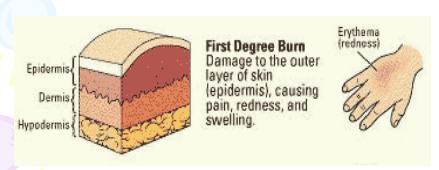 <p>Only cause a redness of the skin, which indicates a mild inflammation. The most common is sunburn. All are considered minor.</p>