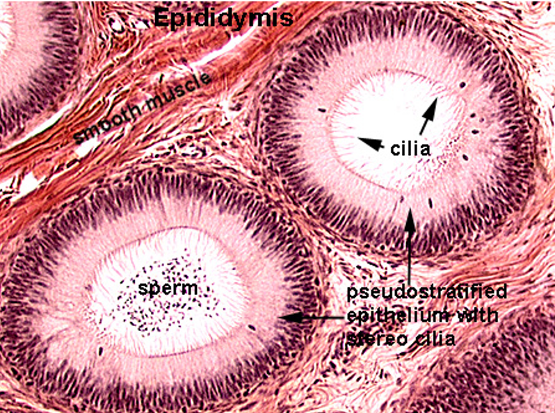 <p class=""><strong>Epididymis</strong></p><ul><li><p class=""><strong>Long, coiled duct</strong> with a <strong>regular, round lumen</strong></p></li><li><p class=""><strong>Cytoplasm has no nuclei in it (unlike seminif. tubules)</strong></p></li><li><p class="">Lined by <strong>pseudostratified columnar epithelium</strong> with <strong>stereocilia</strong></p></li><li><p class="">Surrounded by <strong>smooth muscle</strong></p></li><li><p class=""><strong>Sperm</strong> often visible in the lumen</p></li></ul><p class=""></p><p></p>