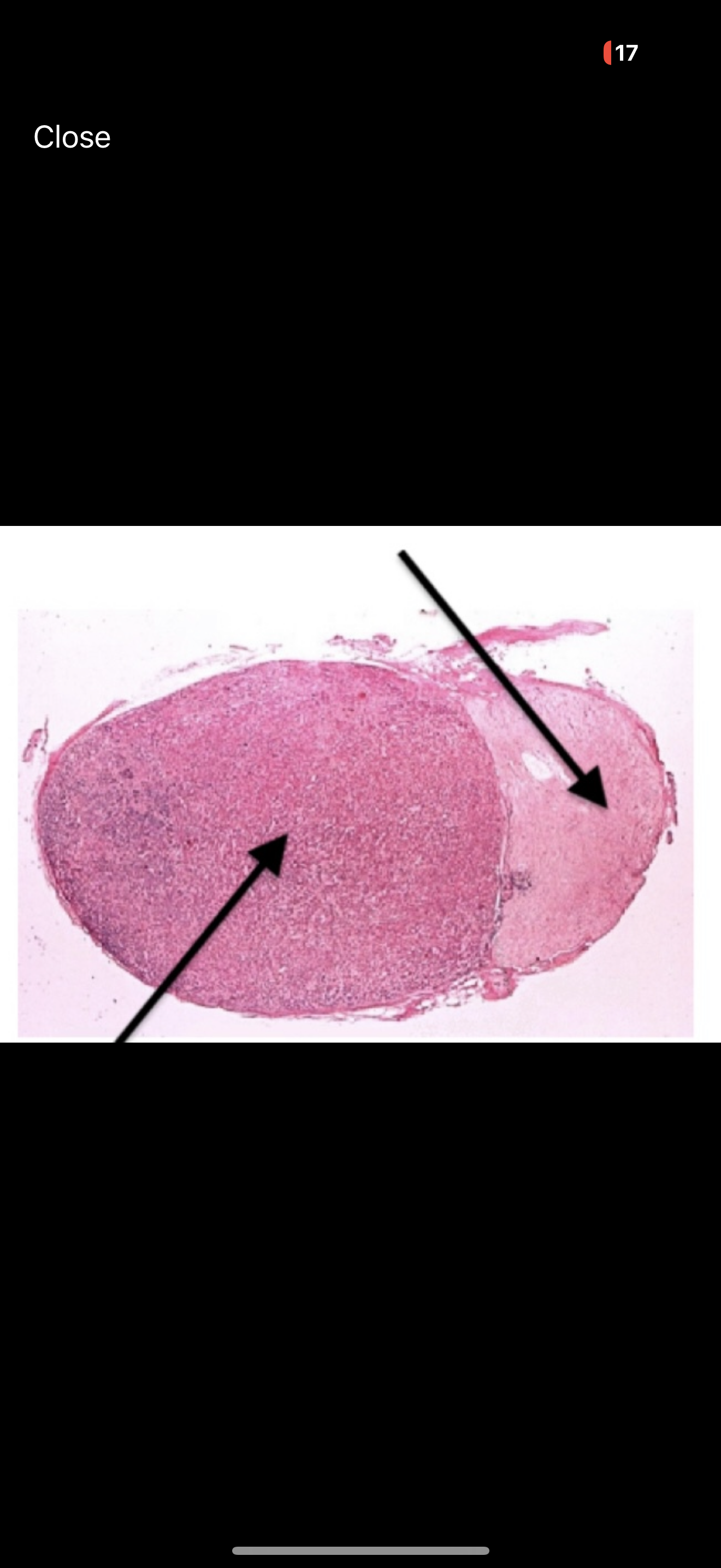 <p>What hormone is associated with the top arrow?</p>