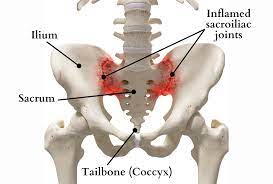 <p>a solid base of the vertebral column that connects to the ilium.</p>
