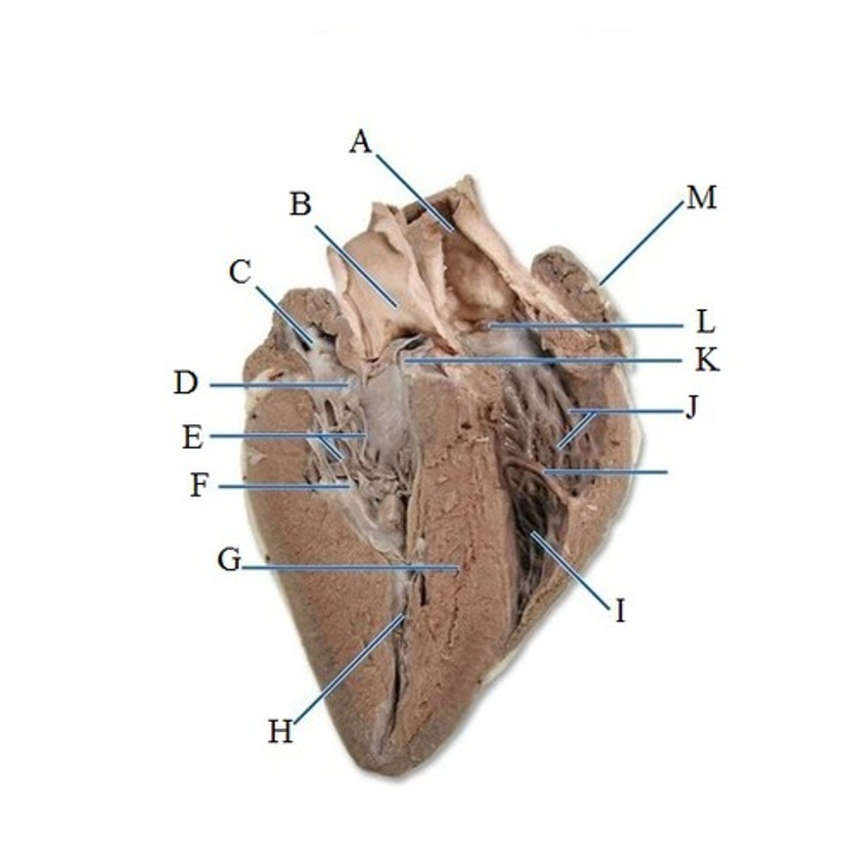 <p>F (muscle)</p>