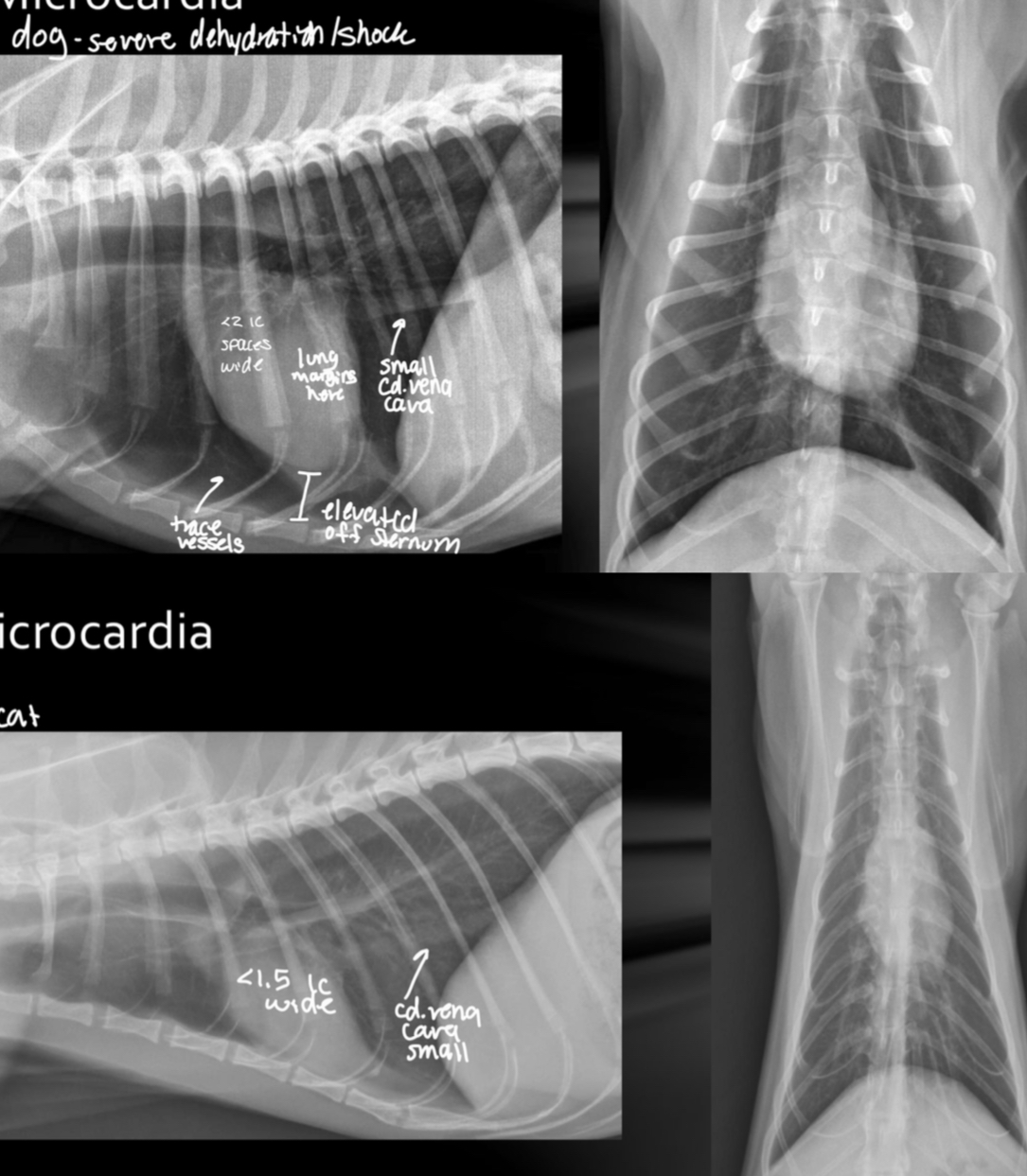 <p>-small cardiac silhouette (<2 IC in dog, <1.5 IC in cat)</p><p>-pulmonary hypoperfusion (small vessels)</p><p>-consistently small CdVC</p><p>-lung margins visible</p><p>-heart elevated off sternum</p><p>-still can trace vessels</p>