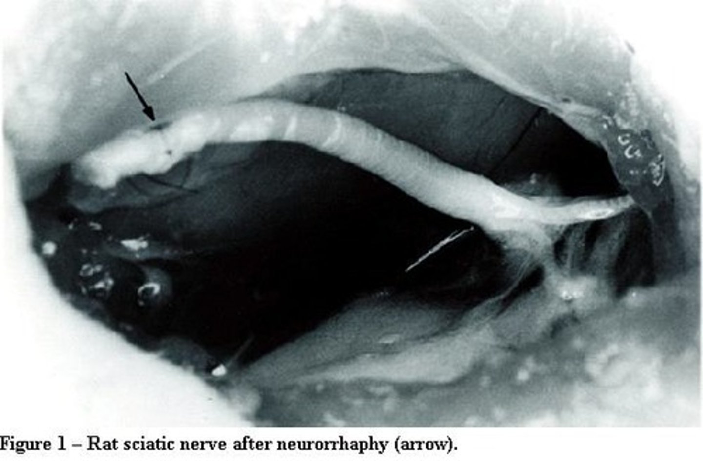<p>Major nerve supplying the lower limb.</p>