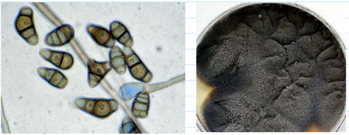 <ul><li><p><span>Black wooly surface</span></p></li><li><p><span>Matures in 5 days</span></p></li><li><p><span>Reverse is black</span></p></li><li><p><span>Dark multi-celled conidia arise from pores on the Geniculate conidiophore</span></p></li><li><p><span>One of the central cells of the conidia grows faster than the others</span></p><ul><li><p><span>That’s why it curves</span></p></li></ul></li></ul><p></p>