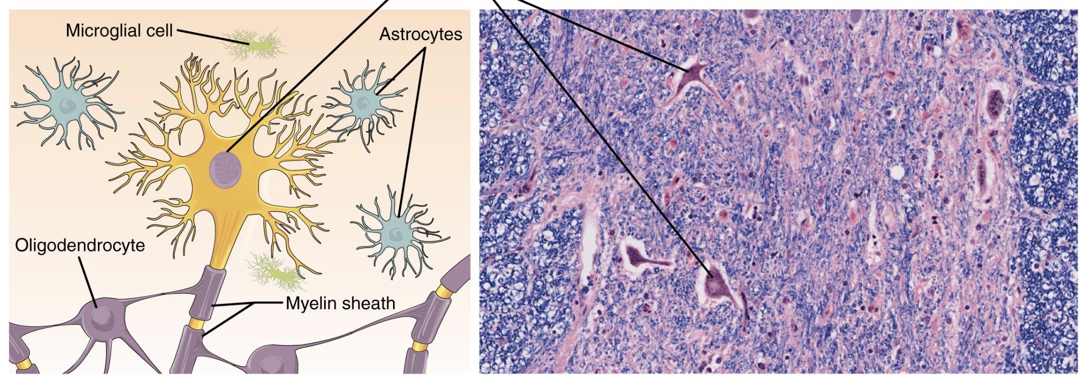 <p><strong>-contains neurons which conduct electrical impulses and supporting <mark data-color="yellow" style="background-color: yellow; color: inherit;">glial cells</mark></strong><mark data-color="yellow" style="background-color: yellow; color: inherit;"> </mark>(=majority of nervous tissue; microglical, astrocyctes, oligodendrocyte, etc.)</p><p>-ex: brain, spinal cord, nerves</p>
