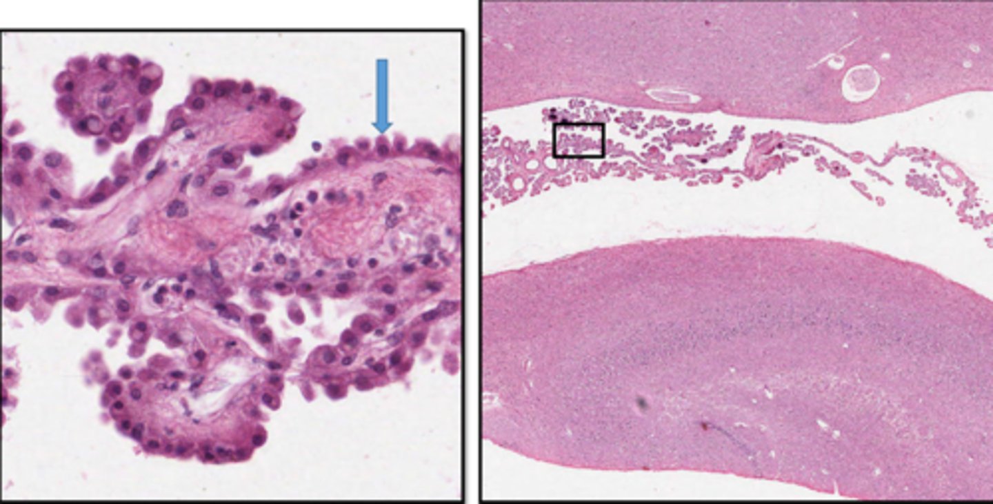 <p>Identify the cuboidal cells on the surface of this choroid plexus</p>