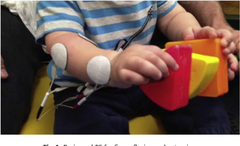 <p>Strengthening programs</p><p>Use of neuromuscular electrical stimulation </p>