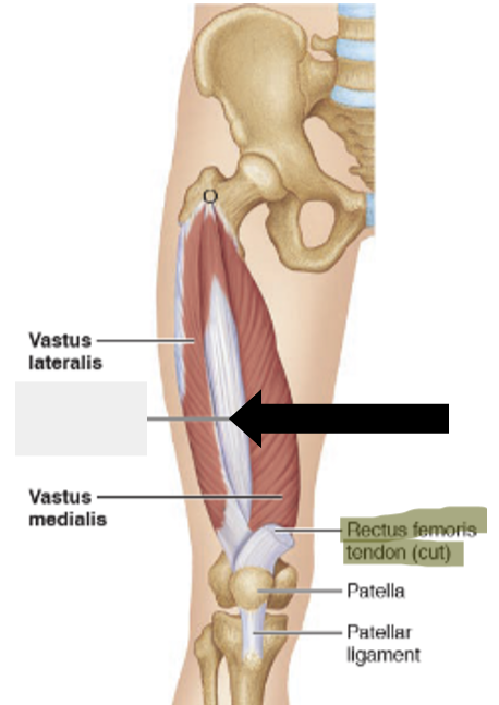 <p>What muscle is the yellow line indicating? </p>