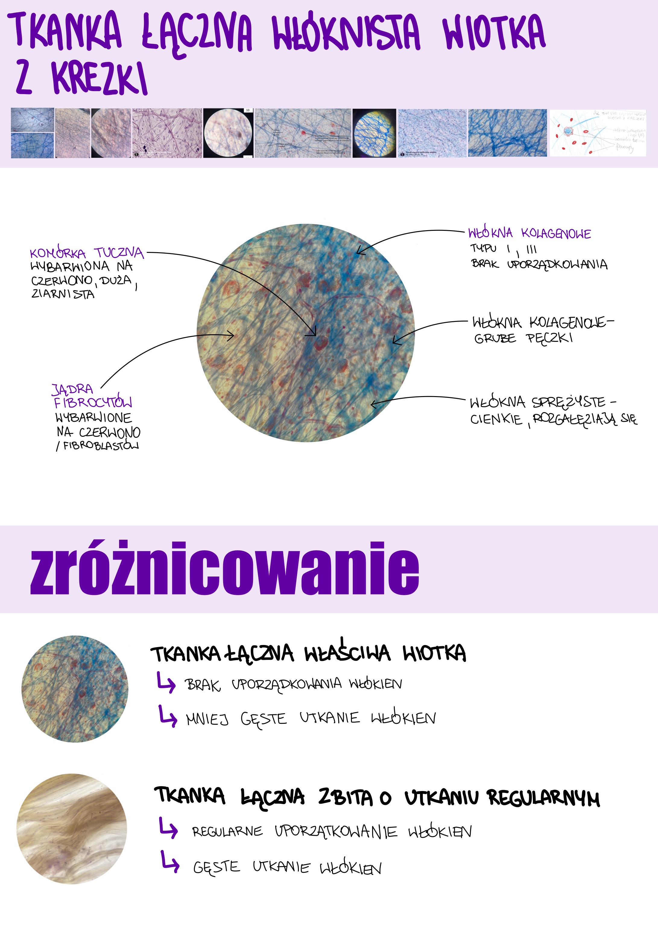 <p>Tkanka łączna włóknista wiotka z krezki</p>