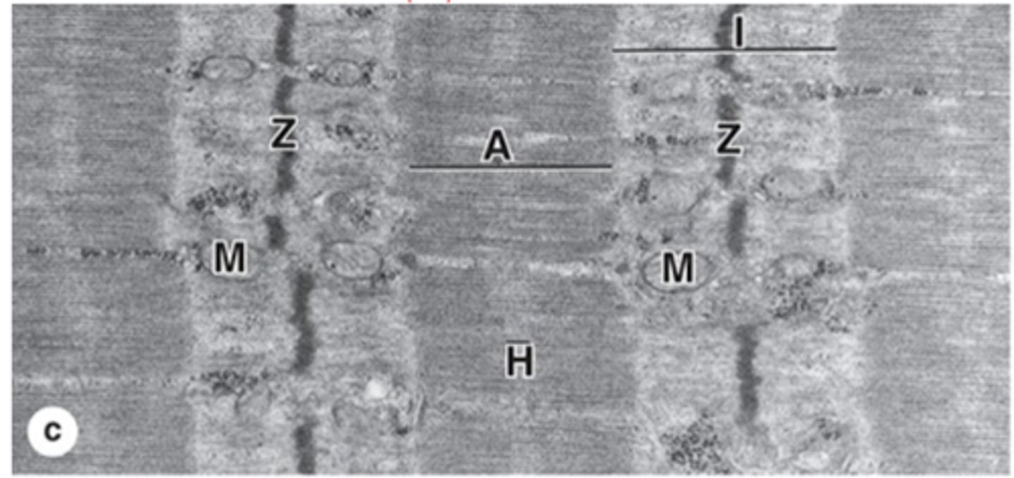 <p>Central lighter zone in A band, no actin.</p>