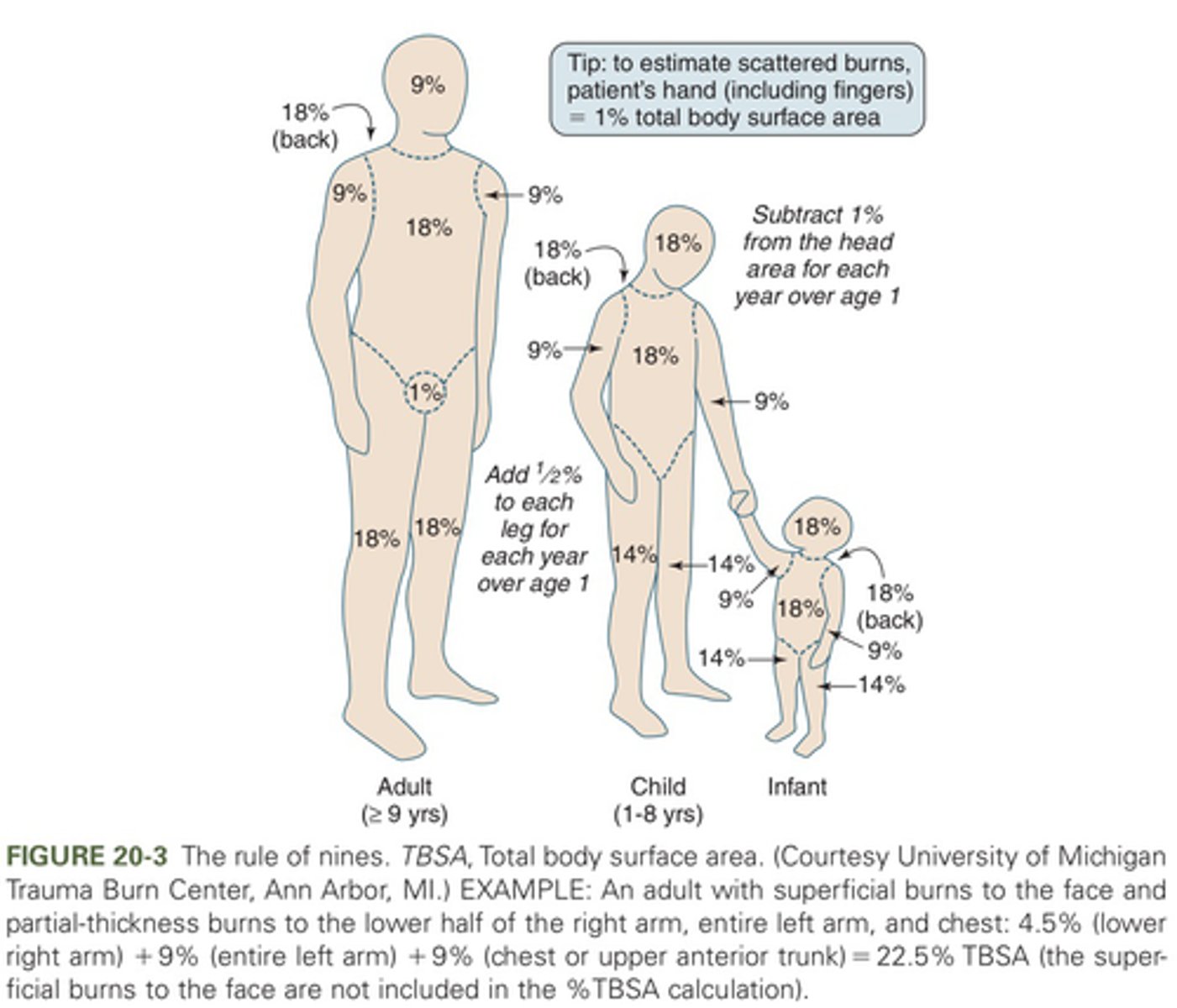 <p>18% entire head, 9% entire arm x 2, 36% entire trunk, 14% entire leg x 2</p><p>(in adults, 9% head, 9% arm x 2, 36% trunk, 18% leg x 2, genitalia 1%)</p>