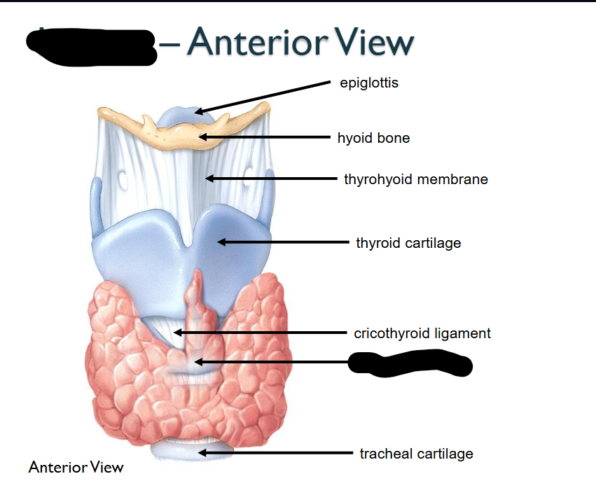 <p>What structure is this within the Larynx?&nbsp;</p>