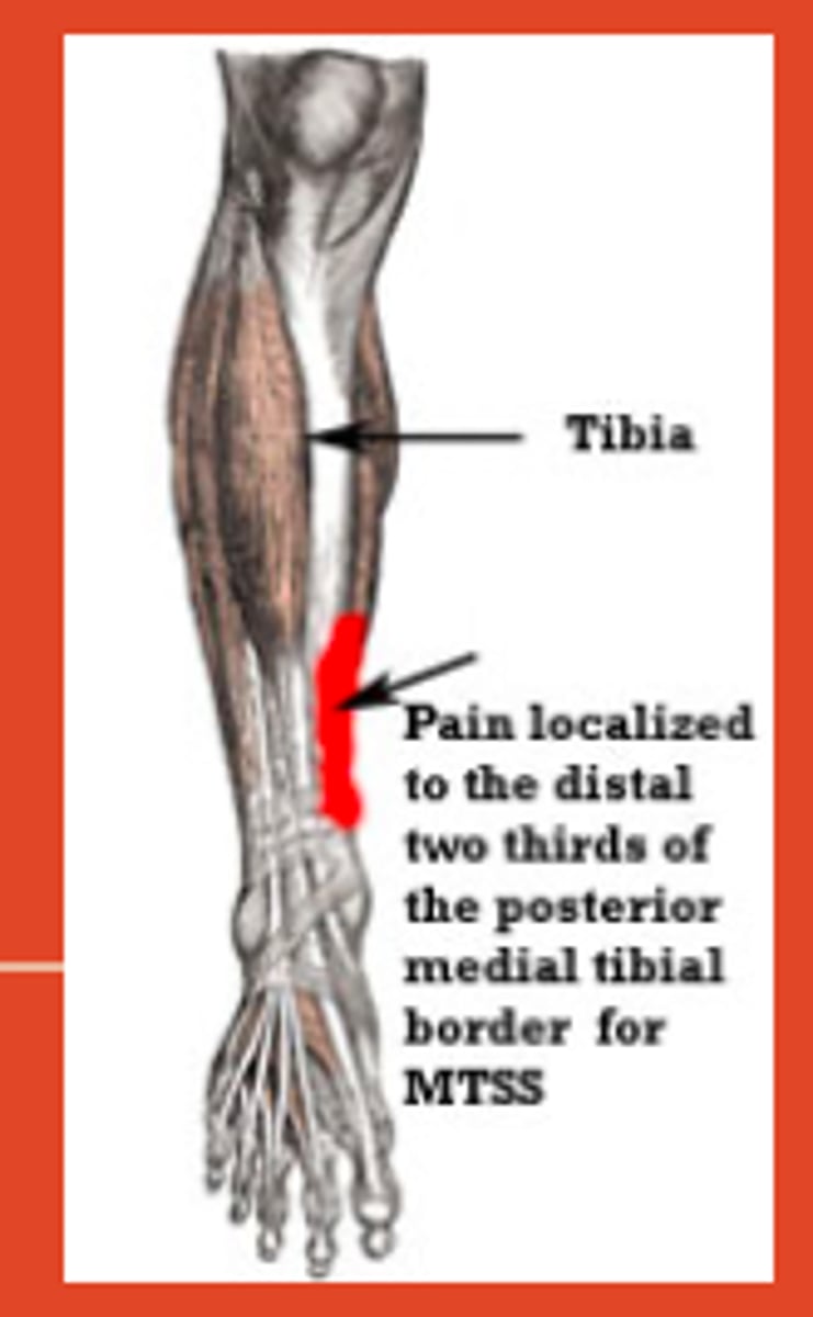 <p>shin splints - inflammation of the tibial periosteum due to repetitive muscle contractions</p><p>- will present with gradual onset of pain in the ANTEROMEDIAL aspect of the distal leg</p>