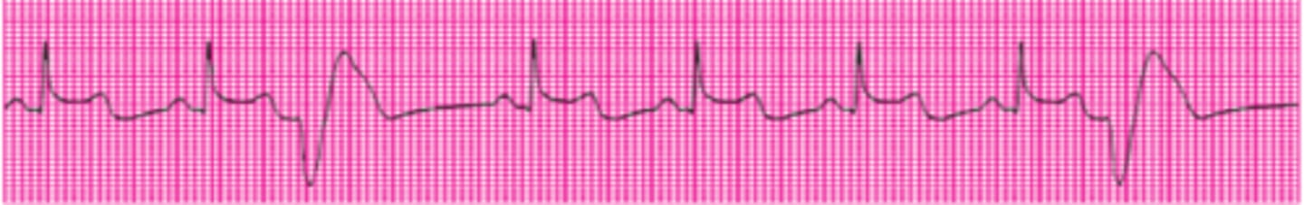 <p>Name this rhythm.</p>