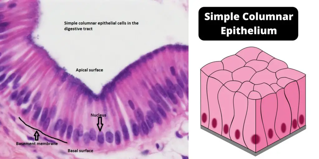 <p>simple columnar </p>