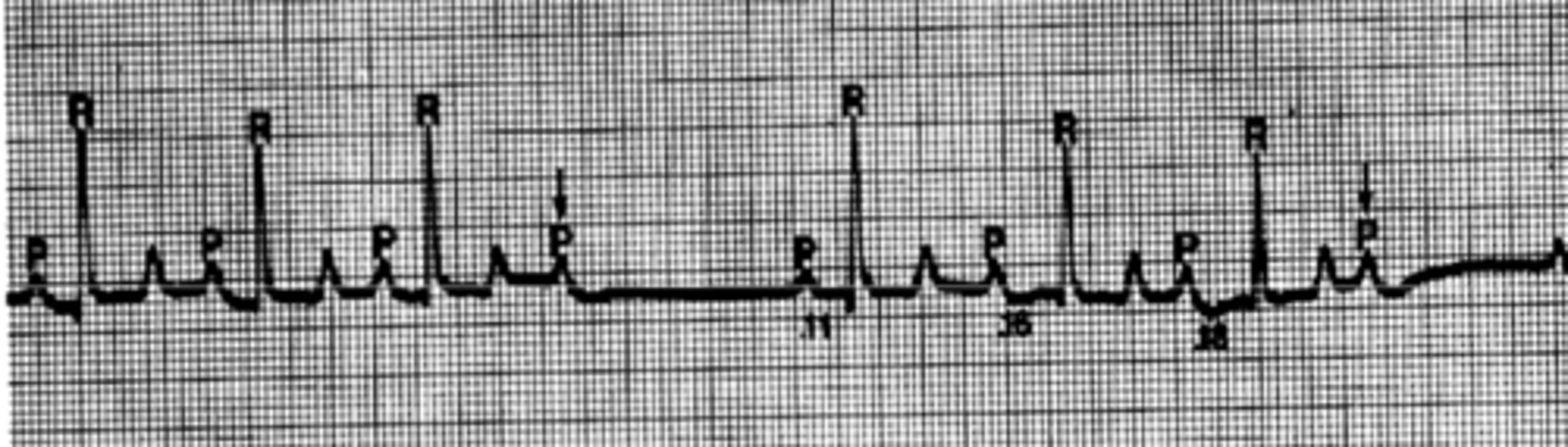 <p>Describe the heart rhythm</p>
