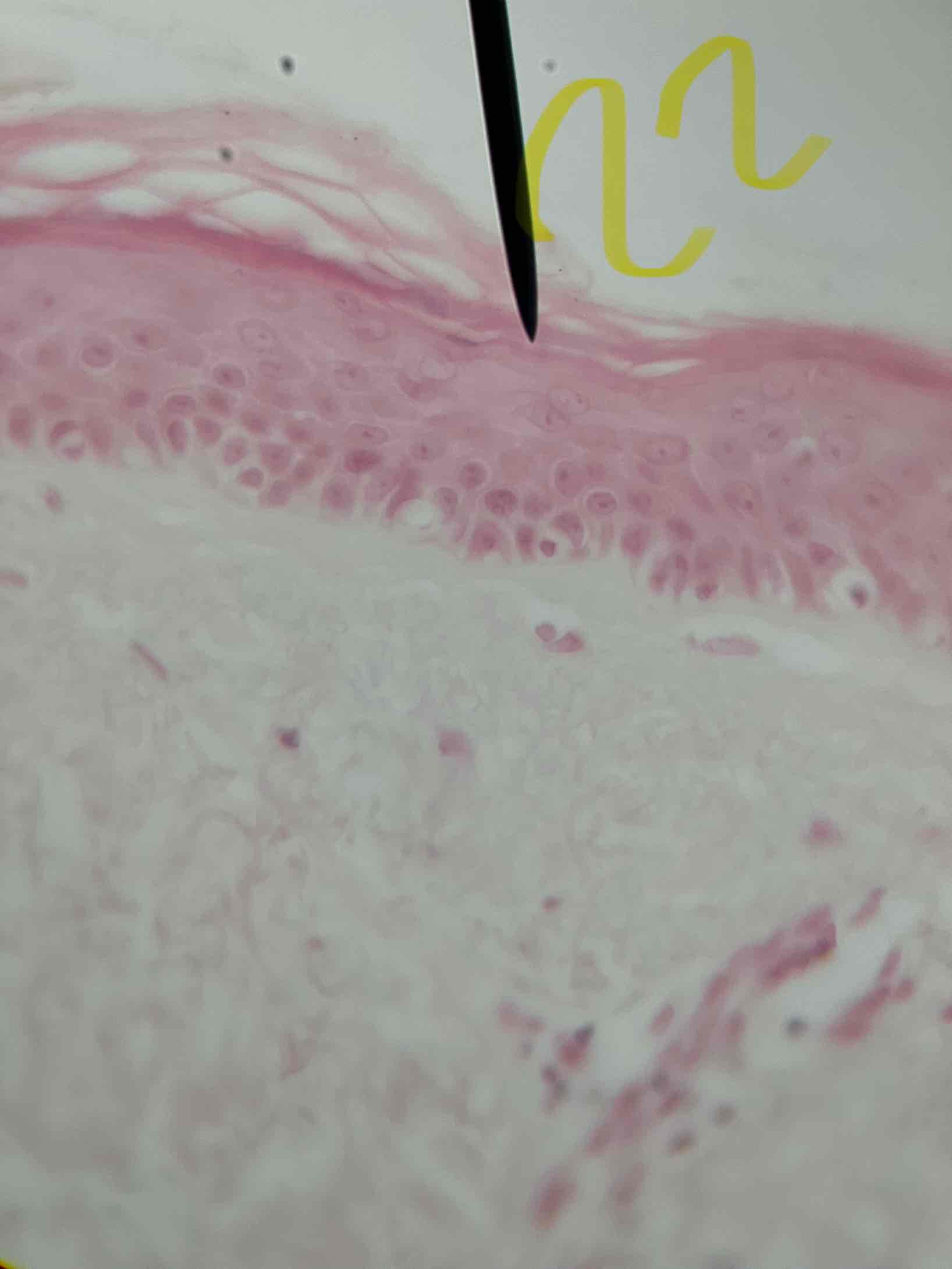 term image
