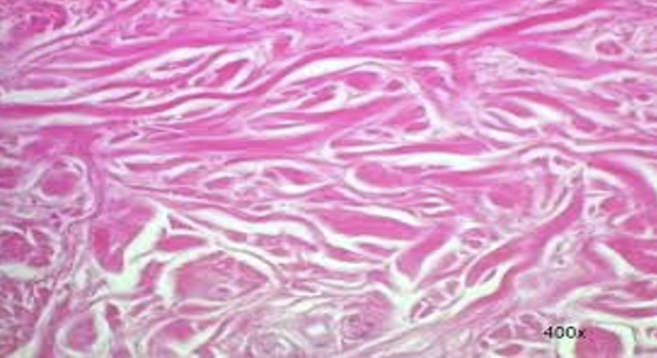 <p>a type of connective tissue characterized by collagen fibers arranged irregularly, providing strength in multiple directions. It is found in the dermis, joint capsules, and organ capsules and digestive tract </p>