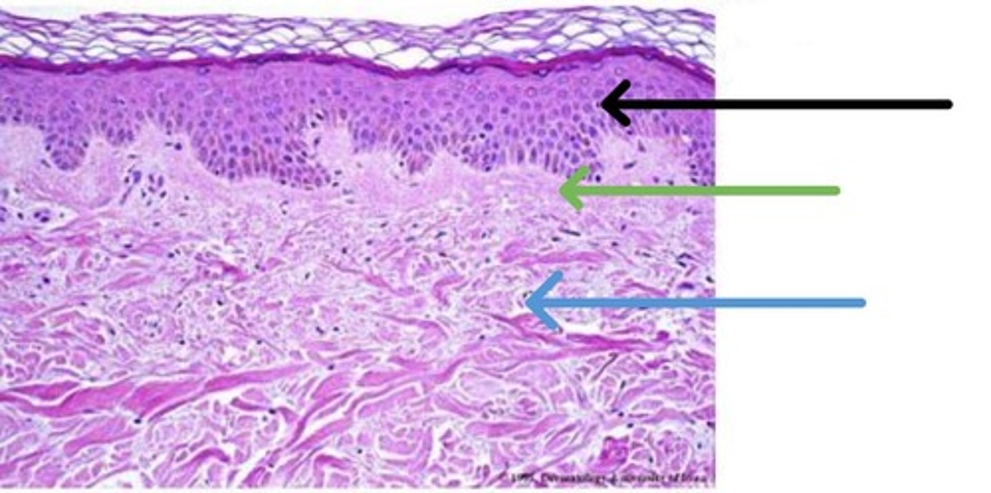 <p>Dermis</p>