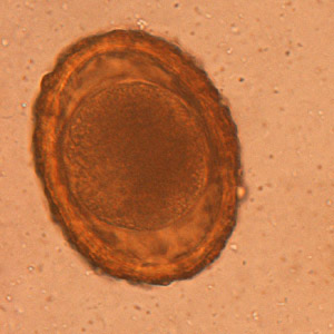 <p>Type of raccoon roundworm eggs </p>