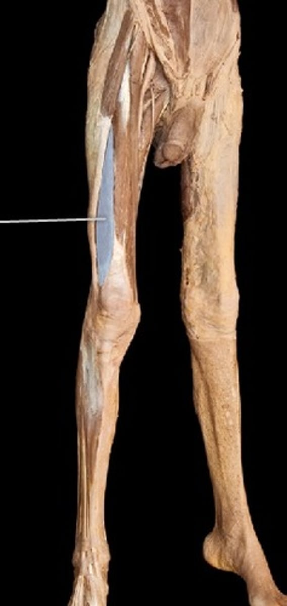 <p>What muscle is this?</p>