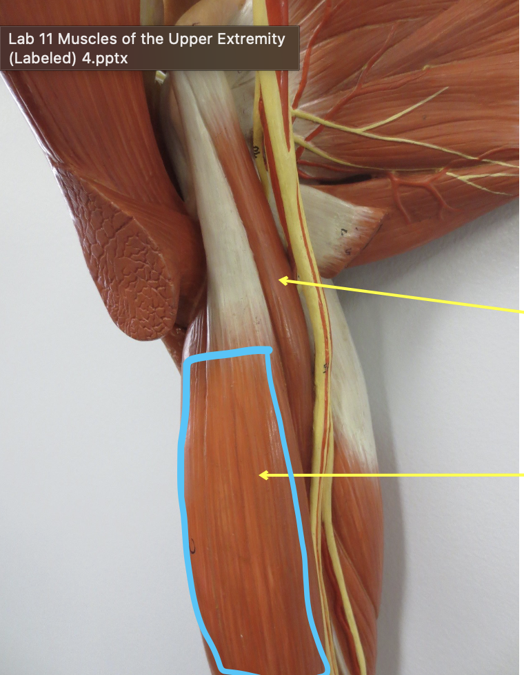 <p>Which muscle</p>