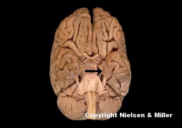 <p>what is indicated nerve</p>