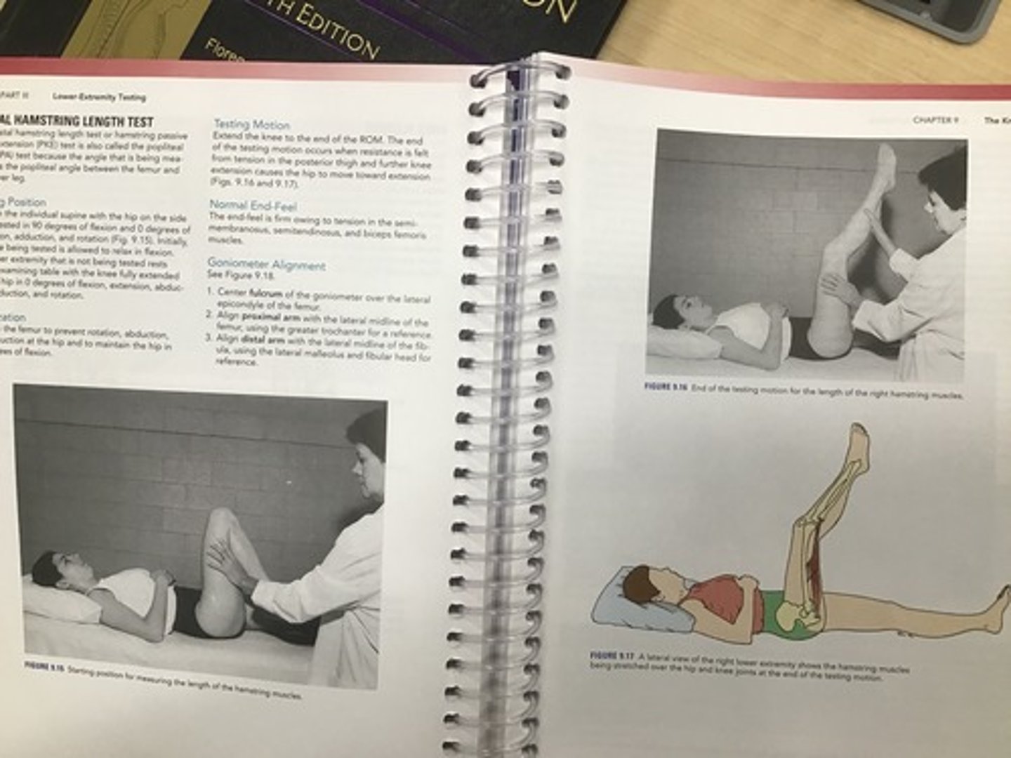 <p>•The distal hamstring length test or hamstring passive knee extension (PKE) test is also called the popliteal angle (PA) test</p><p>•Testing position: Supine, hip flx to 90 degrees, knee flexed at rest</p><p>•Stabilization: femur; prevent rotation, ABD/ADD</p><p>•Testing motion: Extend the knee to the end of the ROM. The end of the testing motion occurs when resistance is felt from tension in the posterior thigh and further knee extension causes the hip to move into extension</p><p>•End feel: firm</p><p>•Interpretation: Mean ROM 31 degrees</p><p>•The end of the testing motion occurs when resistance is felt from tension in the posterior thigh and further flexion of the hip causes knee flexion, posterior pelvic tilt, or lumbar flexion</p><p>•Measure to document progress - goniometer alignment as with knee extension</p>