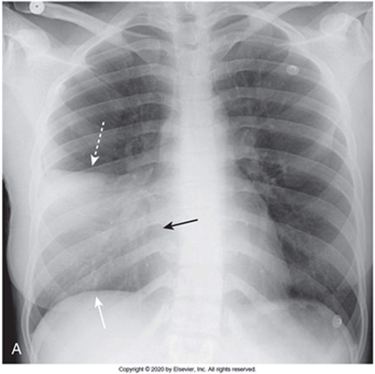 <p>What pathology is this?</p>