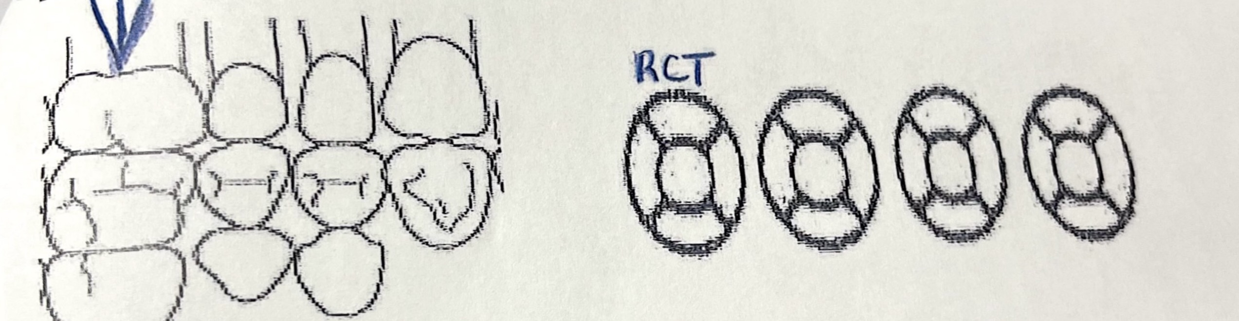 <p>RCT</p>