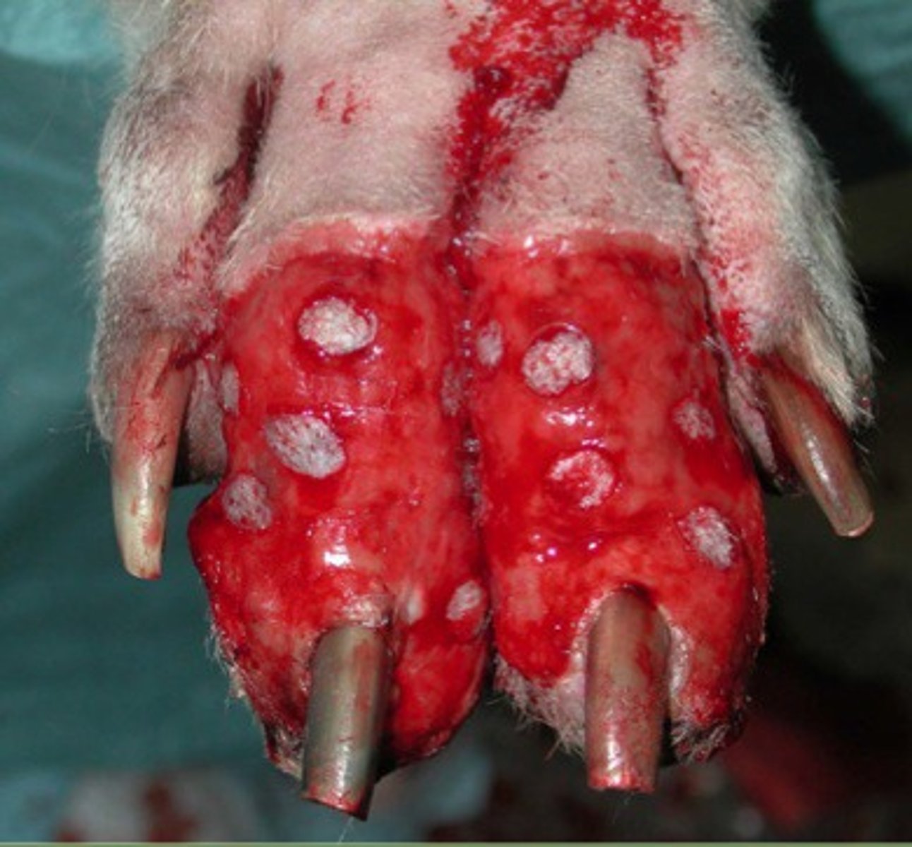 <p>Indications:</p><p>- granulating wounds</p><p>- small wounds</p><p>- contaminated wounds or low grade infection</p><p>- wounds over areas not requiring durability</p><p>- irregular contour</p><p>-Bed pockets: 2-4 mm deep, 5-7 mm apart with scalpel blade</p><p>- Pockets for punch: 1-2 cm apart, 4mm bx punch</p><p>- change first bandage 3-4 days post-op</p><p></p><p></p>