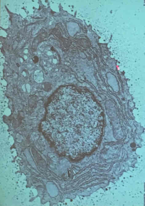 <p>Oval/ round shape</p><p>Round nuclei</p><p>Basophilic cytoplasm</p><p>Contributes greatly to fibers and ground substance to ECM after transformed to chondrocytes</p>