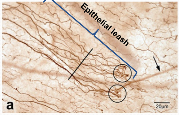 <p>The repeated interconnect </p>