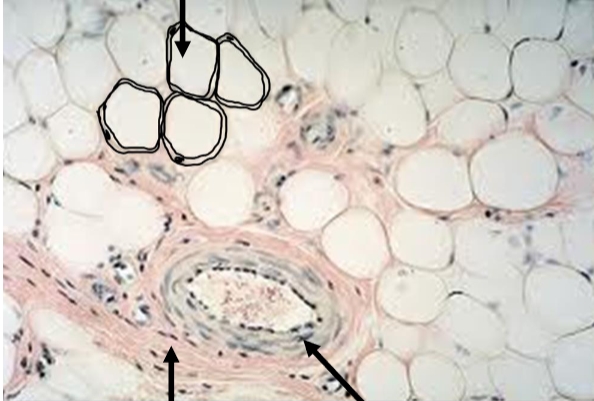 <p>Type of tissue</p>