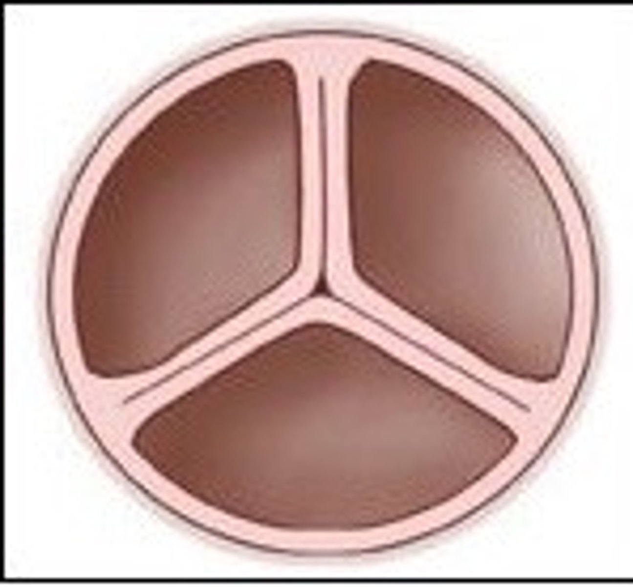<p>Right AV valve (tricuspid)</p>