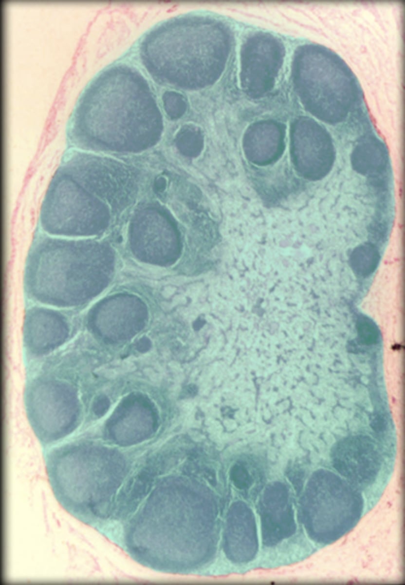 <p>What lymphatic structure is highlighted in this image?</p>