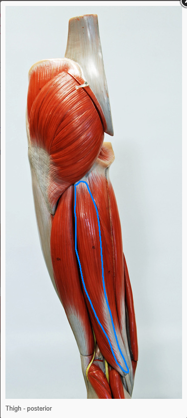 <p>What is the action of the muscle circled </p>