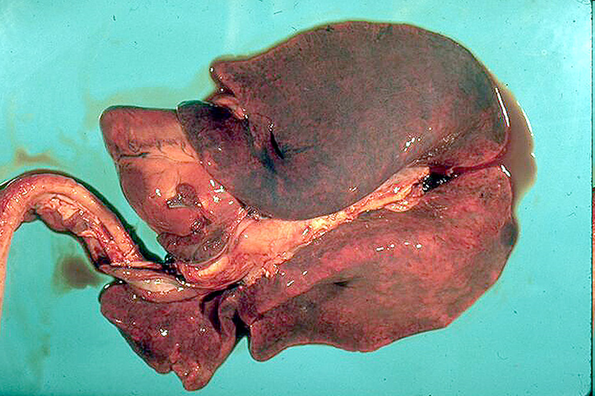 <p>What organ is this? Give a morphological description, morphological diagnosis, disease diagnosis, and possible etiology</p>