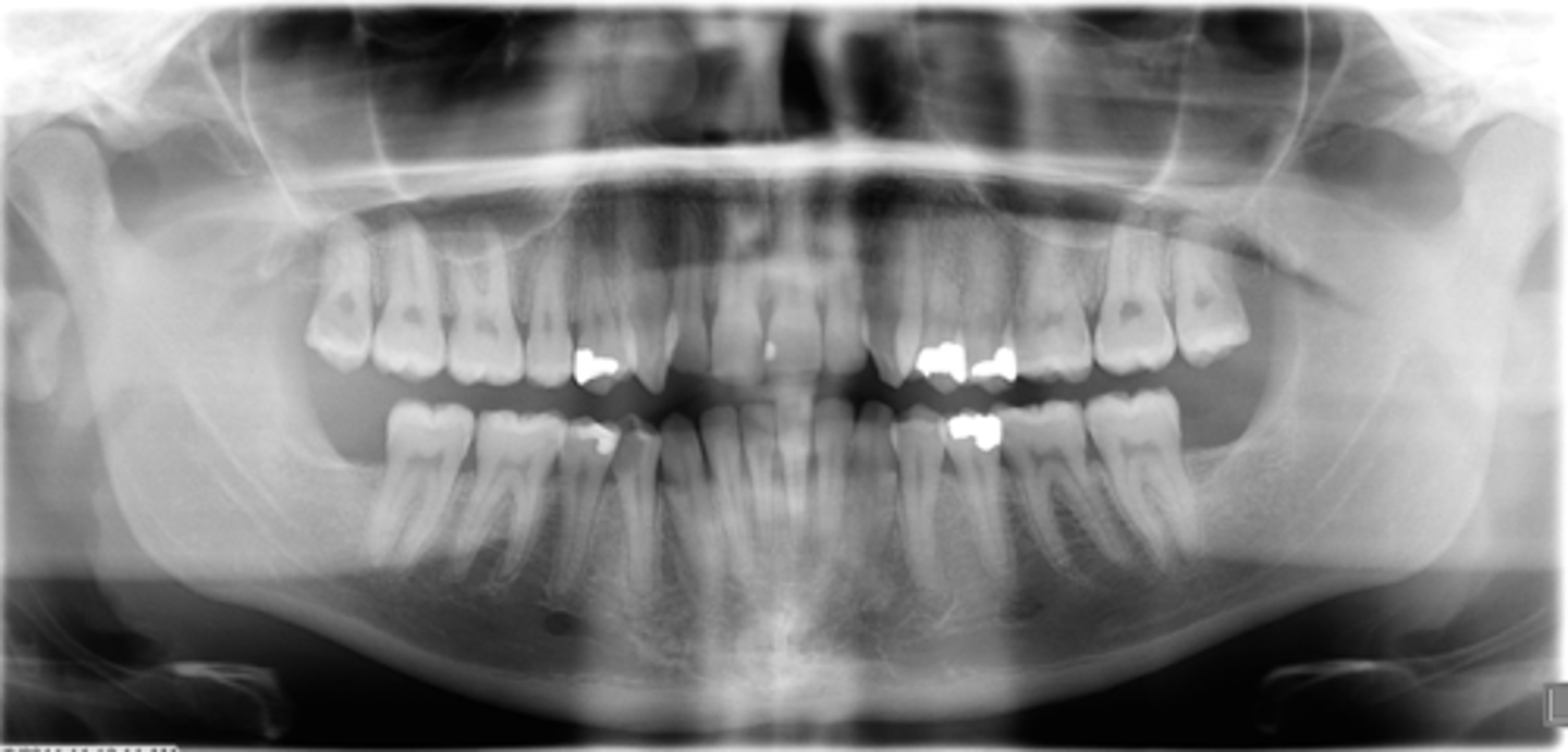 <p>ID the positional error from the radiograph:</p>