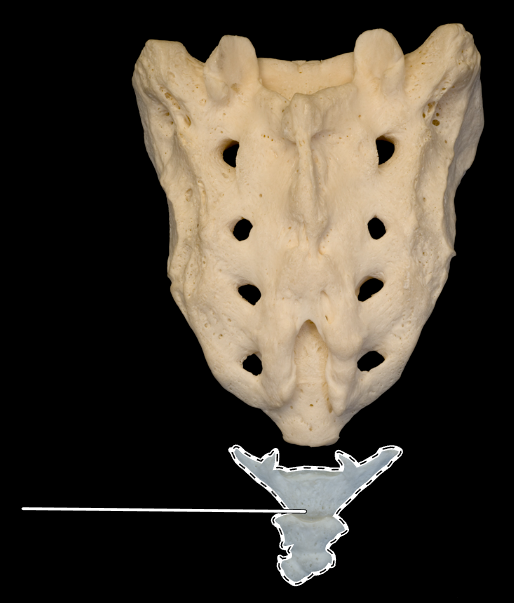 <p>What is the highlighted bone called?</p><p>(Posterior view).</p>