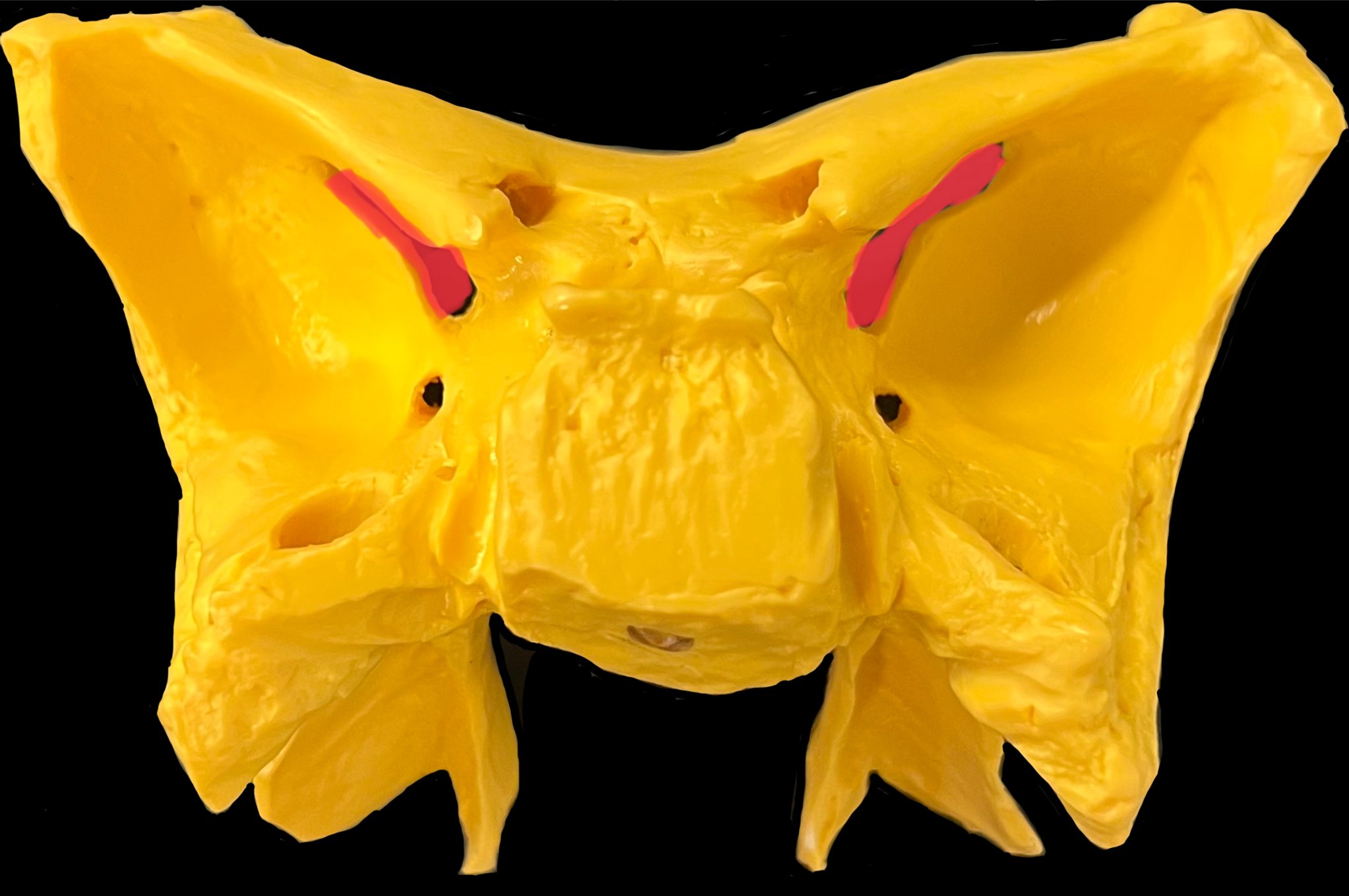 What is highlighted in red?

What goes through it?