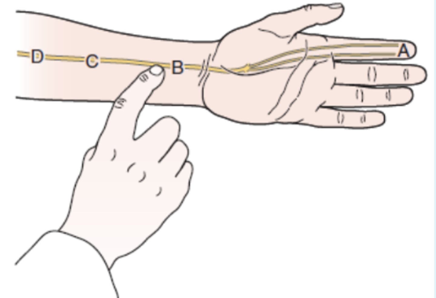 <p>- carpal tunnel compression of median nerve</p><p>(+): tingling or paresthesia into thumb, index finger, and middle and lateral half of the ring finger</p>