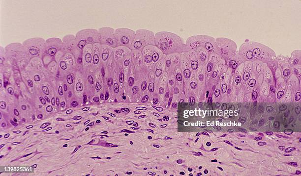 <p>What tissue is this?<br>What location?</p>