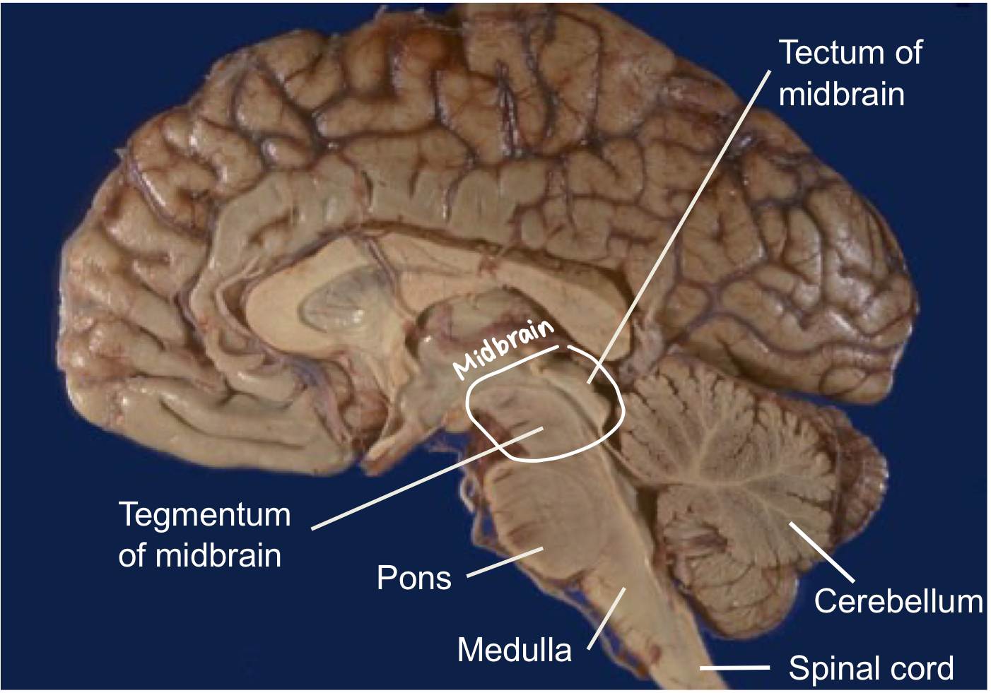 <ul><li><p>Tectum (dorsal region) — tic tac toc</p></li><li><p>Tegmentum (ventral region) </p></li></ul><p></p>