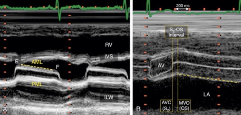 <p>What is this image showing</p>