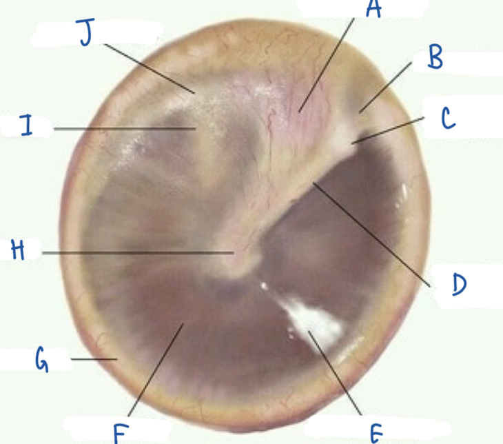 <p>What part of the tympanic membrane is labeled H?</p>